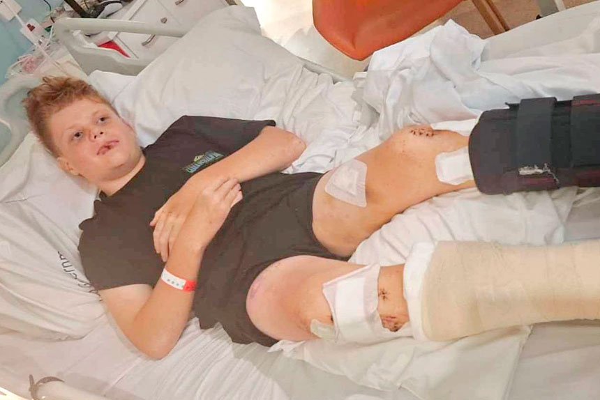 LUCKY ESCAPE: It may not look like it, but things could have been worse for Jacob Vesovic.