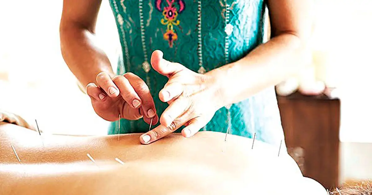 MAKING A POINT: Alternative therapies are a recent discovery for many.